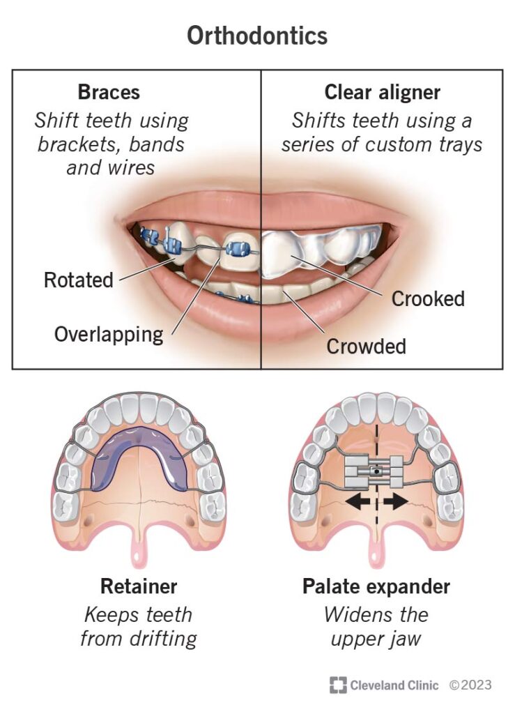 Orthodontics